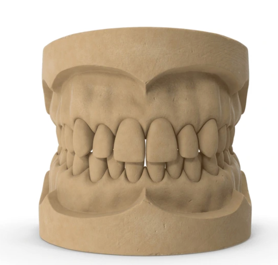 Dental Impression Mould (Stored for 1 Year- Perfect For Emergency Replacement)