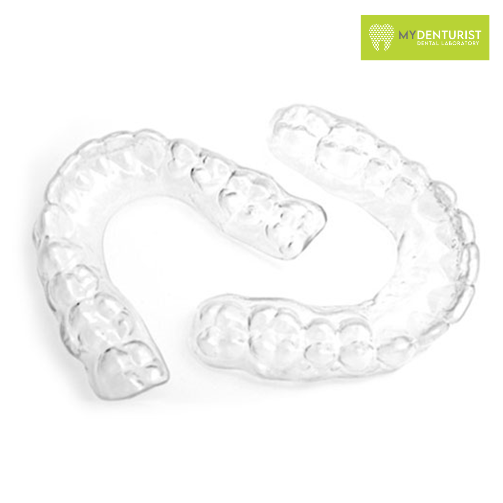 Gouttière de Rétention Orthodontique-Essix Transparente sur Mesure 1,0 mm